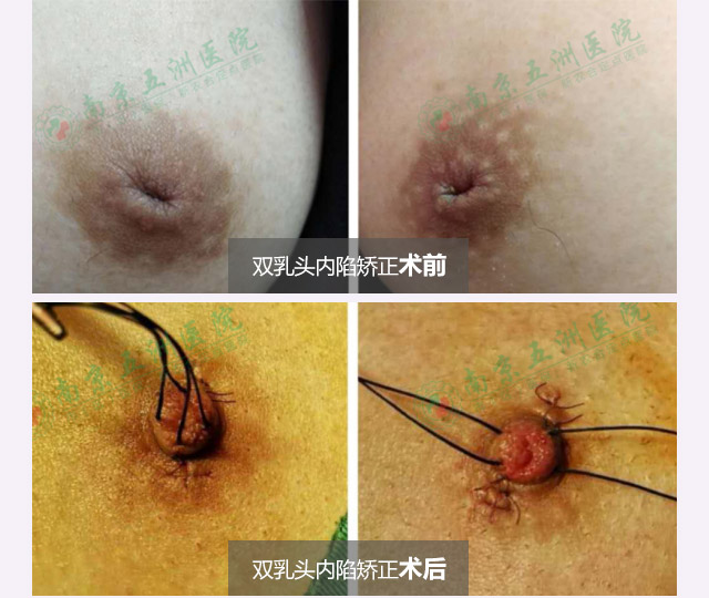 ����������Ч���Ա�